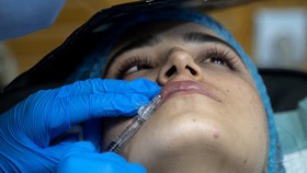FOTO: Botox di Balik Cadar, Tren Operasi Plastik Wanita Afghanistan
