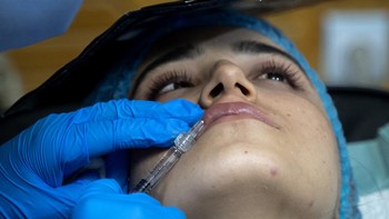 FOTO: Botox di Balik Cadar, Tren Operasi Plastik Wanita Afghanistan