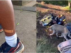 Duh! 15 Pendaki Digigit Anjing Liar di Gunung Batukaru