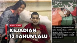 Nadya Almira Dituding Tabrak Lari, Korban Cacat-Keluarga Tuntut Muncul