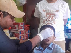 Balita Manggarai Digigit Anjing Liar di Wajah, Tangan, hingga Paha