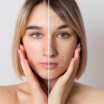 Meski Tampak Sepele, 10 Kebiasaan Ini Perlu Dihindari Kalau Ingin Awet Muda