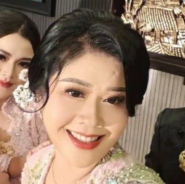 Disebut Senang Punya Mantu Kaya, Paras Mertua Denny Caknan Bikin Salah Fokus