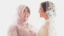 Ibunda Tasya Kamila Jalani Operasi Bariatrik Potong Lambung