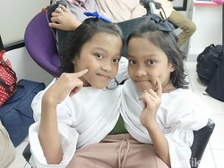 Kisah Kembar Siam Dewi-Putri asal Garut, Makan Bergantian karena Lambung Menyatu