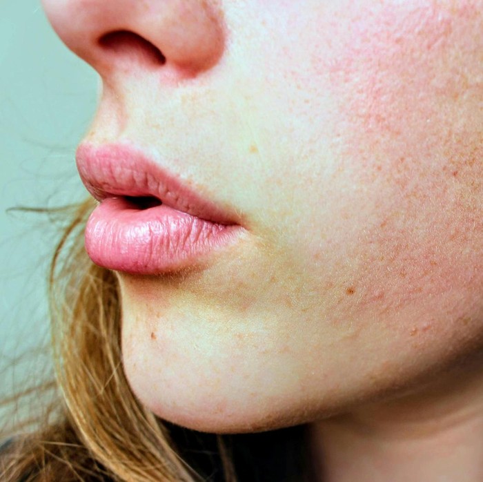 Kulit kering memiliki frekuensi pemakaian sheet mask tersendiri. Pemilik kulit kering dapat memakai produk perawatan kulit ini dua kali dalam satu minggu.