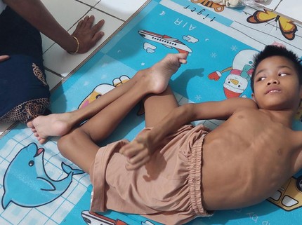 Meliuk Menahan Sakit, Hadijah Ditelantar Ibu Sebab Derita Sakit