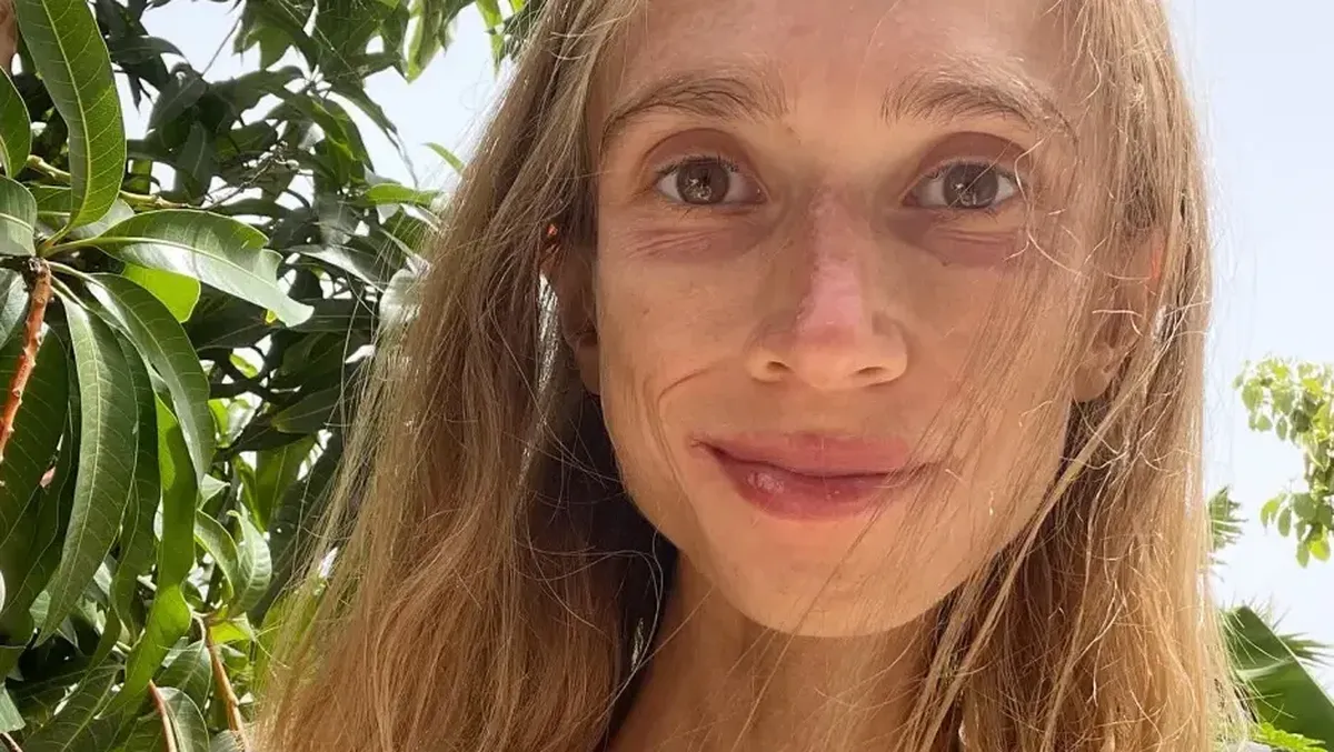 Cerita Wanita Polandia yang Meninggal di Bali akibat Diet Buah Ekstrem