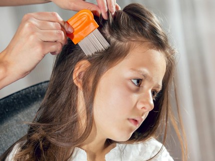 Kutu Rambut: Gejala, Penyebab, dan Cara Mengatasinya pada Rambut Anak