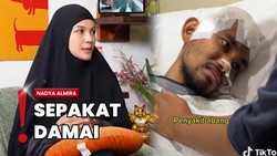 Tudingan Tabrak Lari, Nadya Almira Ngaku Damai-Bayar Rp185 Juta