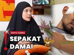 Tudingan Tabrak Lari, Nadya Almira Ngaku Damai-Bayar Rp185 Juta