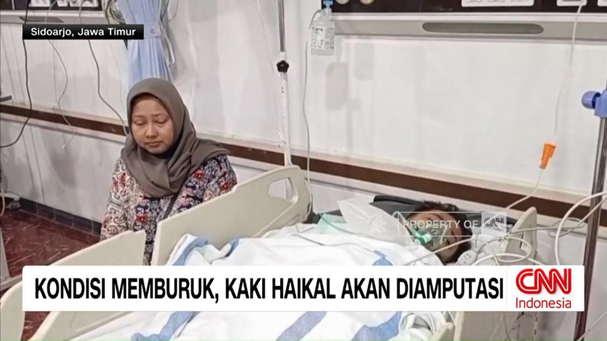 VIDEO: Kondisi Memburuk, Kaki Haikal Korban Ponpes Roboh Akan Diamputa
