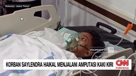VIDEO: Selamat dari Reruntuhan Musala Ambruk, Kaki Haikal Diamputasi