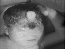 Bayi Ini Terlahir dengan Mata Satu dan Tanpa Hidung, Cuma Bertahan 6 Jam
