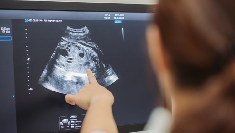 USG kehamilan Close-up of asian chinese young doctor showing ultrasound scan on monitor to pregnant woman in doctor room at hospital