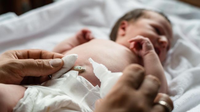 Pusar Bayi Menonjol, Normalkah? Kenali Penyebab, Gejala dan Cara Mengatasinya