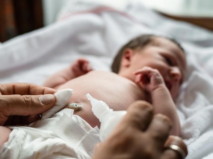 Pusar Bayi Menonjol, Normalkah? Kenali Penyebab, Gejala & Cara Mengatasinya