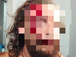 Terduga Penganiaya WN AS di Lombok Bertambah Jadi 8 Orang