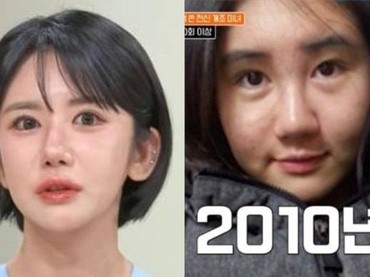 img-title Viral Wajah Wanita yang Lakukan 400 Kali Oplas