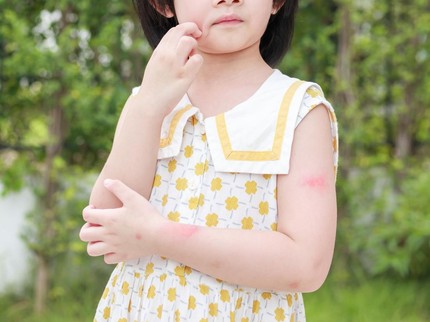 Kasus Alergi pada Anak Meningkat, Jangan Asal Pilih Produk Perawatan Kulit Bayi