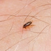 5 Cara Mengobati Gatal dan Bekas Merah Akibat Gigitan Kutu Kucing di Kulit