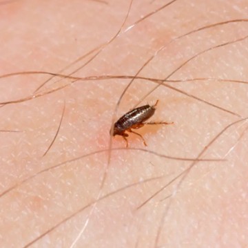 5 Cara Mengobati Gatal dan Bekas Merah Akibat Gigitan Kutu Kucing di Kulit