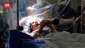 VIDEO: Momen Penderita Parkinson Main Klarinet saat Operasi Otak