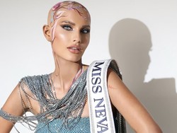 Ratu Kecantikan Alami Alopecia, Kisah Kehilangan Rambut Diabadikan Jadi Gaun