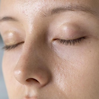 3 Tips Mengatasi Kulit Berminyak, Wajib Catat!