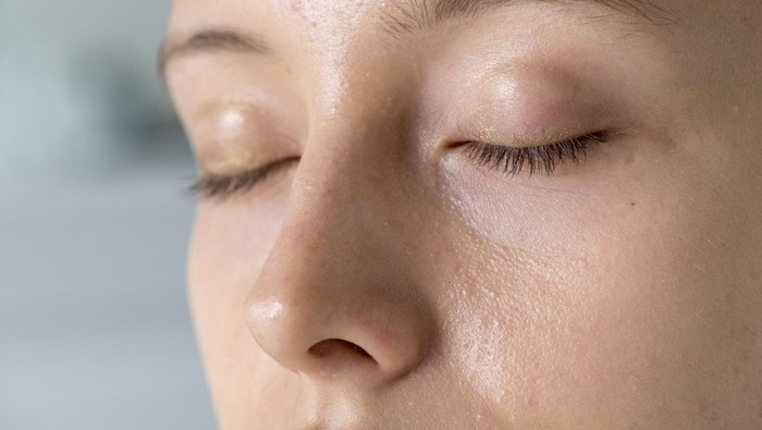 3 Tips Mengatasi Kulit Berminyak, Wajib Catat!