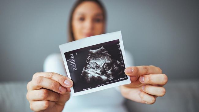 Kisah Perempuan Palsukan Kehamilan, Sempat Bikin Gender Reveal hingga Melahirkan Boneka Plastik