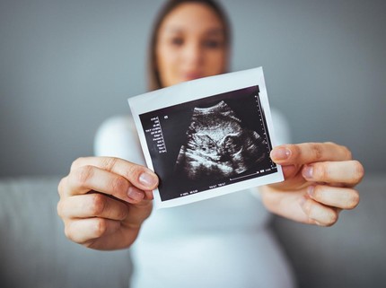 Kisah Perempuan Palsukan Kehamilan, Sempat Bikin Gender Reveal hingga Melahirkan Boneka Plastik