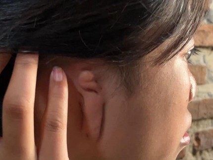 Tak Punya Telinga, Sedari Kecil Nani Dirundung Hingga Menangis