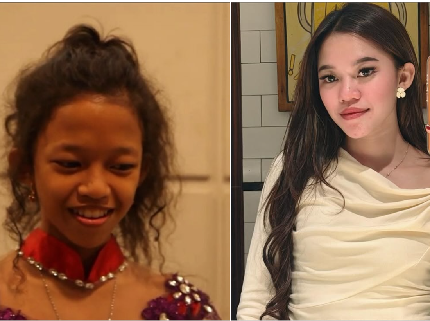 5 Potret Transformasi Ummi Quary Sempat Minder, Kini Dipuji Makin Cantik & Glowing