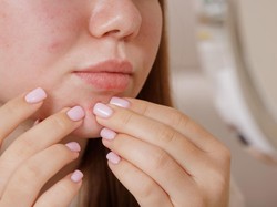 Pakai Sunscreen Jadi Bikin Breakout? Begini Cari Produk Sesuai Tipe Kulit Pakai Sunscreen Jadi Bikin Breakout? Begini Cari Produk Sesuai Tipe Kulit