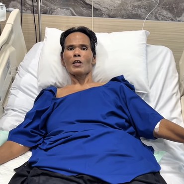 Kondisi Fahmi Bo Usai Jalani Operasi Batu Empedu