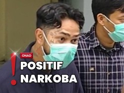 Dinyatakan Sehat, Onadio Bungkam usai Jalani Tes Kesehatan