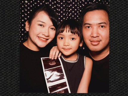 Kinal Eks JKT48 Umumkan Kehamilan Kedua, Intip Potretnya Pamer Foto USG Bareng Suami & Sang Putri