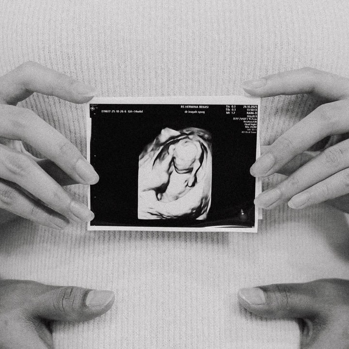 <p>Penyanyi sekaligus pesinetron ini, membagikan kabar kehamilannya ini melalui unggahan video singkat di Instagram. Ochi mengunggah foto hitam putih hasil USG kehamilannya yang diambil pada 26 Oktober 2025. Saat itu, usia kehamilannya sudah memasuki 14 minggu 6 hari. "OTEWEEEE," tulisnya dalam <em>caption</em> unggahan. (Foto: Instagram @ochi24)</p>