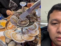 Alergi Parah Usai Makan Seafood di Korea, Pria Ini Berujung Boncos