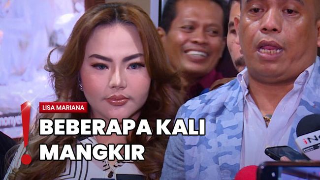 Tersangka Kasus Video Syur, Lisa Mariana Pamer Hidung Diperban di IG