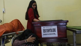 Respons Polda Metro soal Usulan TGPF Temuan 2 Kerangka di Kwitang