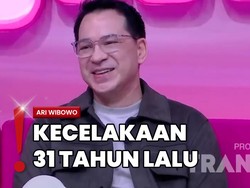 Berkat Facelift, Ari Wibowo Tahu Ada Pecahan Beling Tertinggal di Dagu