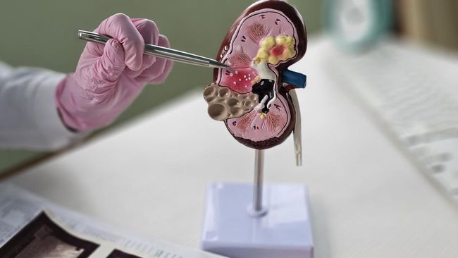 Disangka Flu Biasa, Ternyata Anak Ini Alami Gangguan Ginjal Serius