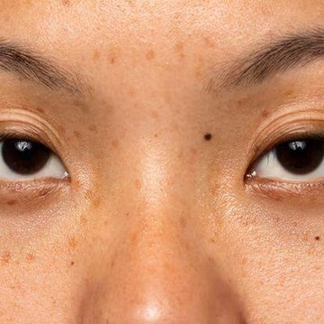 Usir Noda Hitam dan Kulit Kusam, Ini 3 Bahan Ajaib yang Harus Ada di Skincare Kamu