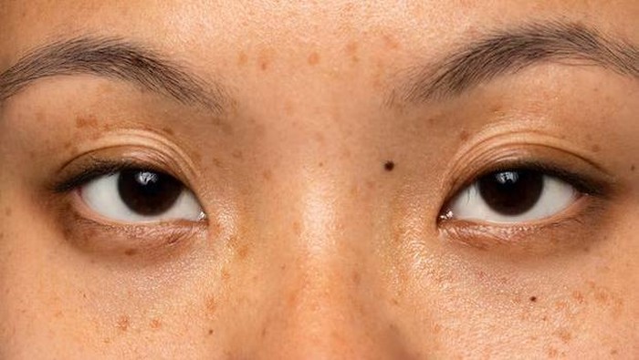 Usir Noda Hitam dan Kulit Kusam, Ini 3 Bahan Ajaib yang Harus Ada di Skincare Kamu