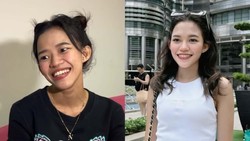 Tanpa Oplas, 7 Potret Transformasi Ummi Quary Tuai Pujian Warganet