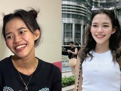 Tanpa Oplas, 7 Potret Transformasi Ummi Quary Tuai Pujian Warganet