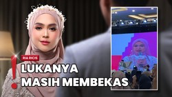 Ria Ricis Curhat Luka Perceraian, Pernah Ragu dan Marah pada Tuhan