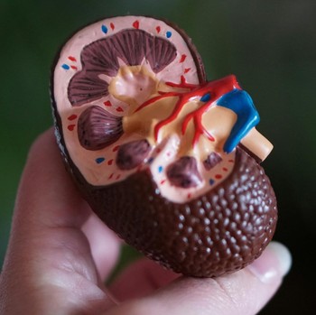 Jangan Tunggu Parah, Kenali 7 Ciri-Ciri Fungsi Ginjal yang Bermasalah